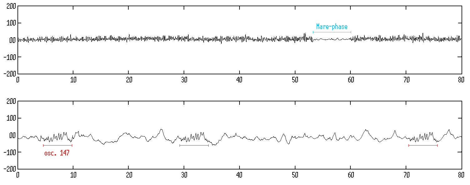 scp1123ru-EEG